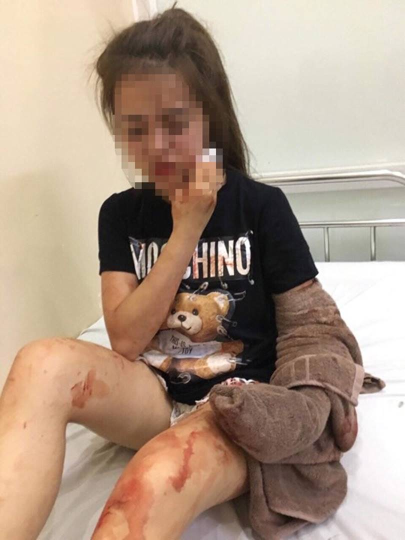 Nghe tin con gái rạch mặt người khác, mẹ ngã gục tại bệnh viện-2