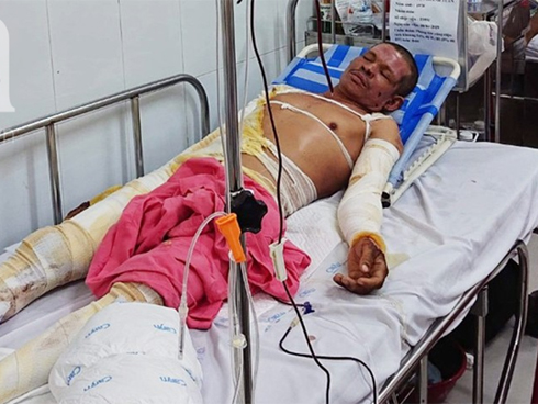 Hàng trăm người dân tháo chạy thục mạng khỏi chung cư bốc cháy dữ dội ở Sài Gòn-1