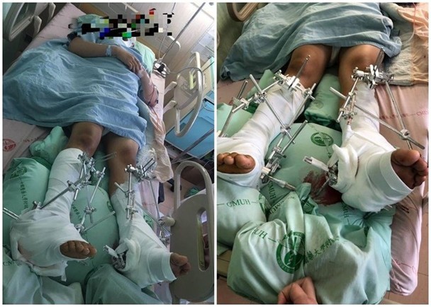 Bị bạn bắt nạt, nam sinh nhảy lầu tự tử nhưng may mắn không chết, thầy hiệu trưởng đồng ý bồi thường kèm điều kiện gây phẫn nộ-2