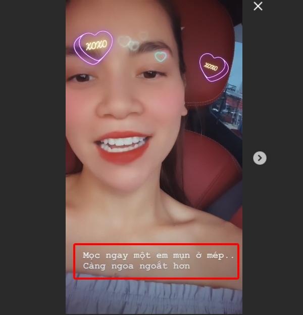 Nắng Sài Gòn đáng sợ quá, đến Hà Hồ cũng bị nổi mụn, lại ngay chỗ ngoa ngoắt hết sức-3