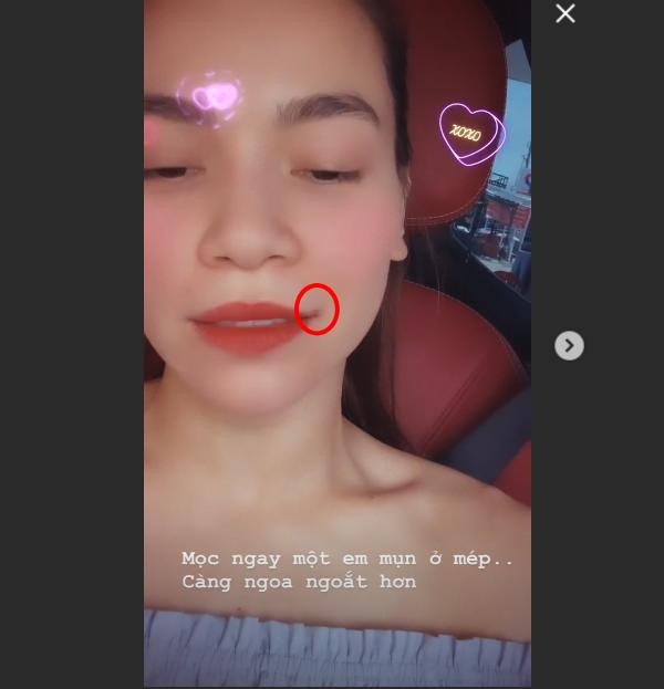 Nắng Sài Gòn đáng sợ quá, đến Hà Hồ cũng bị nổi mụn, lại ngay chỗ ngoa ngoắt hết sức-4