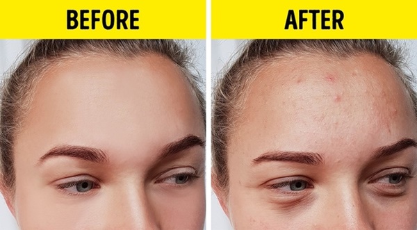 Không thể ngờ 9 sản phẩm làm đẹp phổ biến này lại vô dụng đến vậy-6