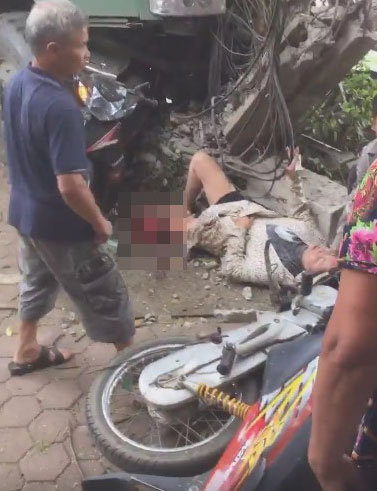 Được người dân băng tạm chân trái nát bét, nữ nạn nhân vẫn tỉnh táo ngóc đầu dậy-1