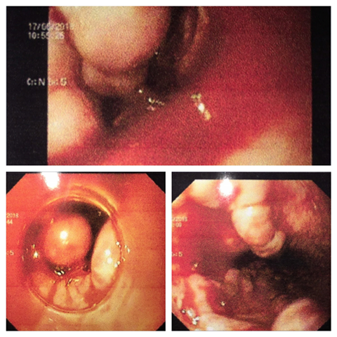BS phát hoảng vì bệnh nhân nôn hàng lít máu tươi: Thủ phạm là thứ đồ uống nhiều người mê-2