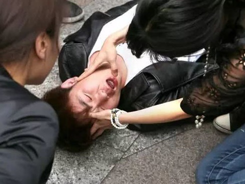 Thiếu nữ 15 tuổi bất ngờ đột quỵ, triệu chứng rất hay gặp ai cũng cần biết-5