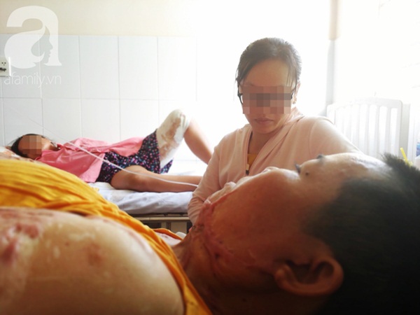 Người phụ nữ bị tình cũ tạt axit bỏng nặng sau khi níu kéo tình cảm không thành-7