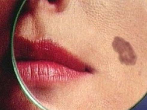 Cô dâu mang bầu 7 tuần phải cắt tử cung, chị em ghi nhớ dấu hiệu này để phòng ngừa-3