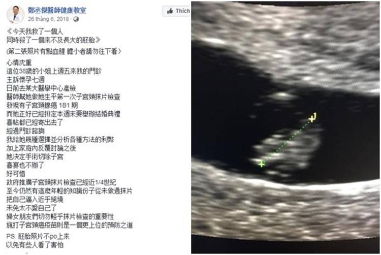 Cô dâu mang bầu 7 tuần phải cắt tử cung, chị em ghi nhớ dấu hiệu này để phòng ngừa-1