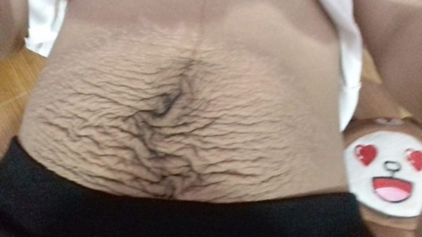 Khoe da bụng sau khi sinh nhăn như táo tàu, mẹ trẻ khiến chị em xót xa: Không gì khổ bằng nghề làm mẹ-1