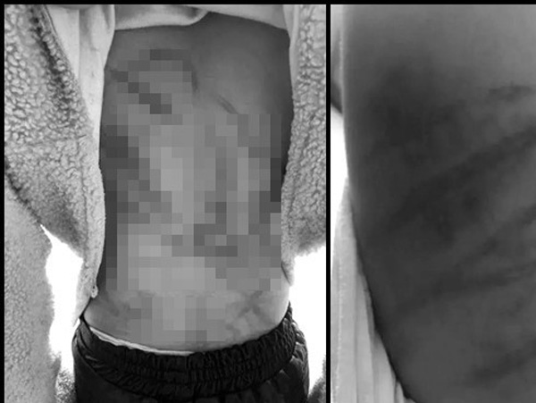 Bé gái 10 tuổi cầu cứu hàng xóm vì người con đau quá, sau đó họ đã phát hiện hình ảnh kinh hoàng đằng sau lớp áo-1