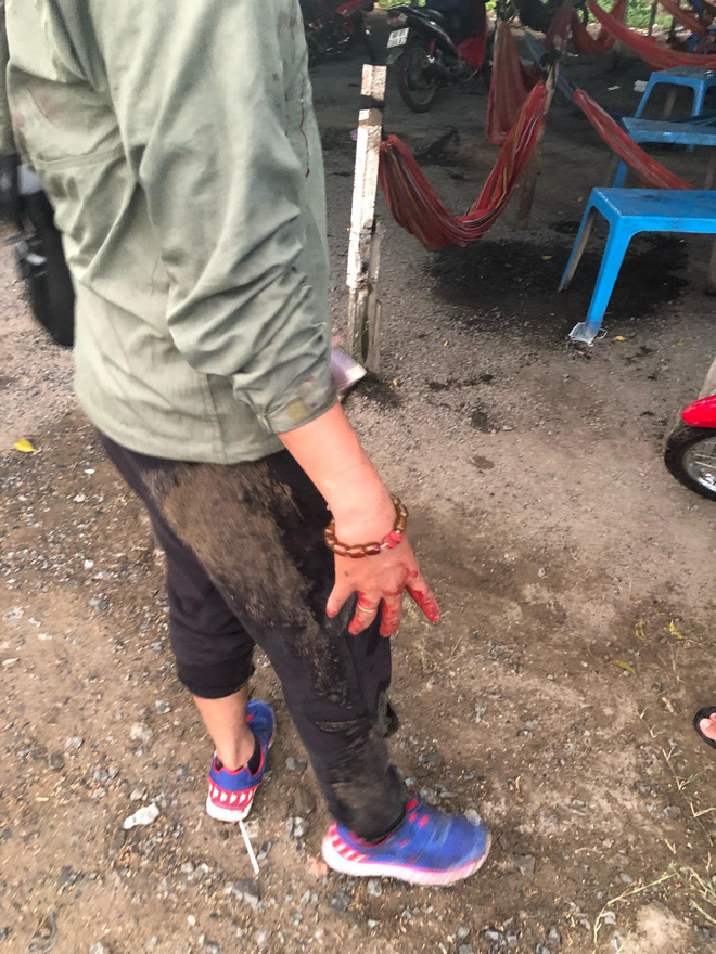 Thắc mắc vì sao hủ tíu bình dân giá cắt cổ” 100.000 đồng/tô, khách bị chủ quán hành hung đổ máu-3