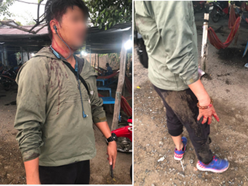 Người mẹ mang khối u khổng lồ, giành giật sự sống từng ngày để sinh con: Em muốn nhìn con lớn một chút nữa rồi chết-12