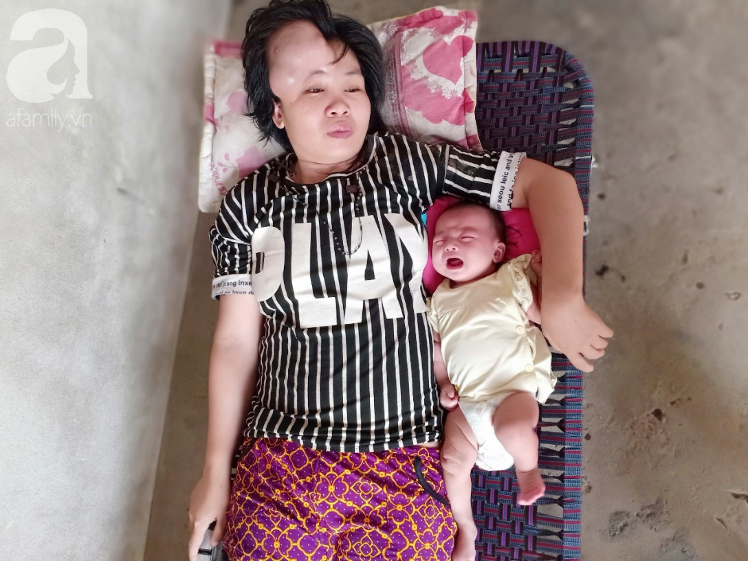 Người mẹ mang khối u khổng lồ, giành giật sự sống từng ngày để sinh con: Em muốn nhìn con lớn một chút nữa rồi chết-1