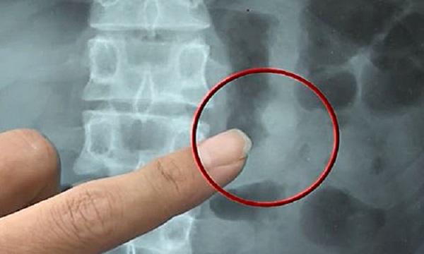 Buổi sáng thức dậy nghe thấy tiếng nhạc phát ra từ bụng mình, chàng trai tá hỏa phát hiện mình đã làm điều quái đản lúc ngủ-2