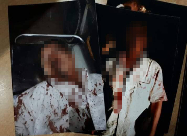 Chồng bị đánh thừa sống thiếu chết, nghi do vợ đi vay nặng lãi tiền tỷ không trả-1