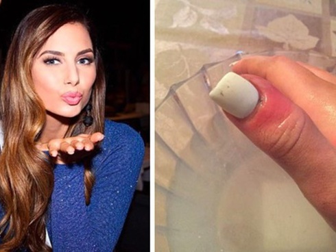 Sự thật từ bệnh nhân 7 năm điều trị ung thư: Rất nhiều người bệnh ung thư tự giết nhau-4