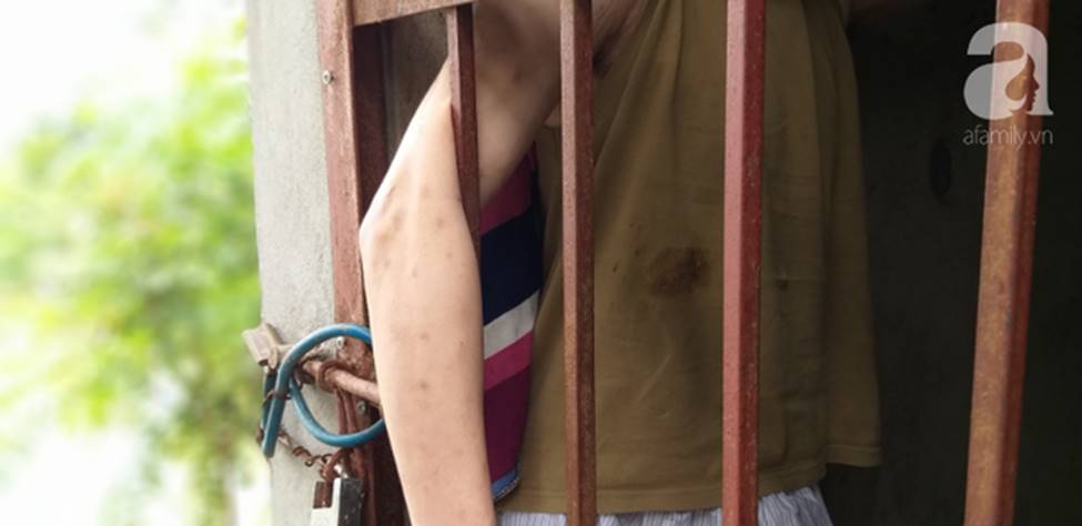 Vụ con trai bị bố ruột nhốt như vật nuôi trong chuồng đầy ruồi muỗi: Chúng tôi đã nhiều lần góp ý nhưng ông ấy không nghe-6
