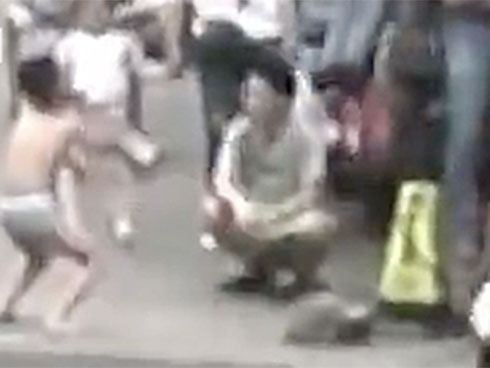 Cậu bé 3 tuổi suýt mất mạng sau khi ăn xúc xích, cha mẹ vạn lần không được cho con vừa ăn vừa làm điều này-3