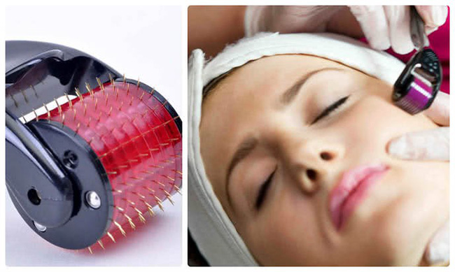 Từ vụ 2 người bị nhiễm HIV sau khi lăn kim, chuyên gia muốn bạn nhớ rõ điều này-1