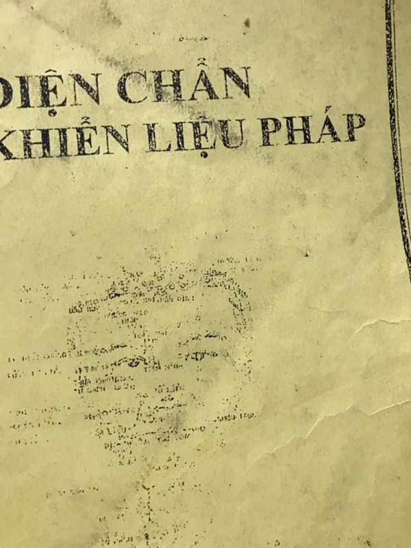 Sau nửa năm điều trị chứng xuất huyết não, bệnh tình của diễn viên Thúy Anh giờ ra sao?-1
