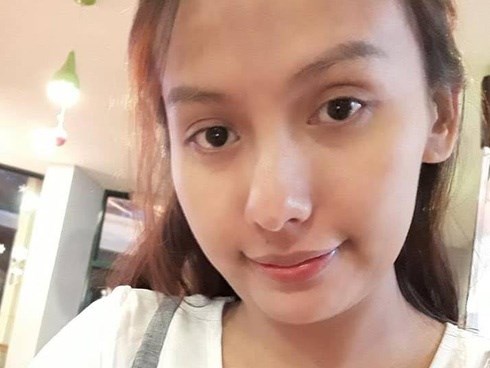 Sau nửa năm điều trị chứng xuất huyết não, bệnh tình của diễn viên Thúy Anh giờ ra sao?