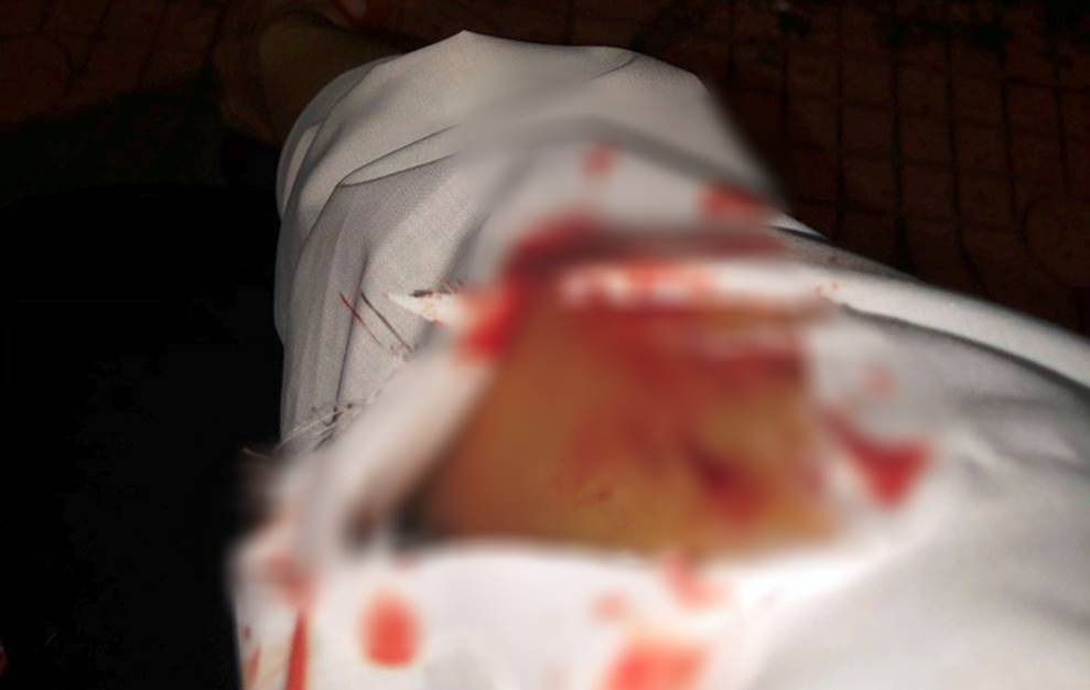 Bị 2 kẻ biến thái dùng vật nhọn đâm chảy máu khi dừng đèn đỏ, cô gái trẻ ở Sài Gòn phải điều trị chống phơi nhiễm HIV-1