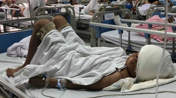 Máu trộn bùn ruộng khắp người em bé Thanh Hoá bị 2 con chó becgie cắn-1