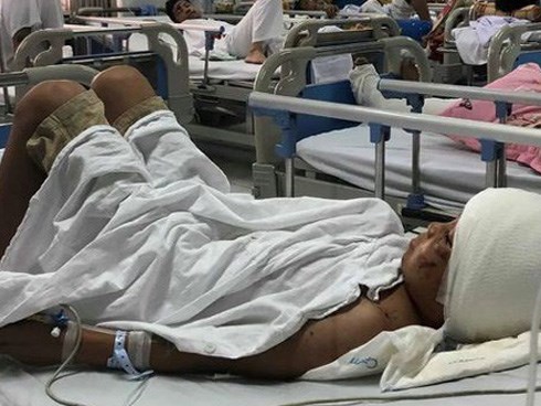 Máu trộn bùn ruộng khắp người em bé Thanh Hoá bị 2 con chó becgie cắn