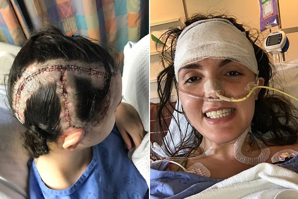 Thiếu nữ 15 tuổi bất ngờ đột quỵ, triệu chứng rất hay gặp ai cũng cần biết-1