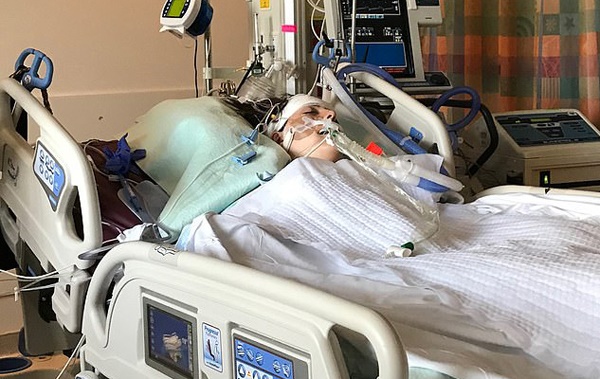 Thiếu nữ 15 tuổi bất ngờ đột quỵ, triệu chứng rất hay gặp ai cũng cần biết-2