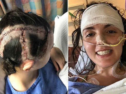 Sơ cứu bệnh nhân đột quỵ bằng những cách này, bạn đang đẩy người thân đến gần cửa tử hơn-4