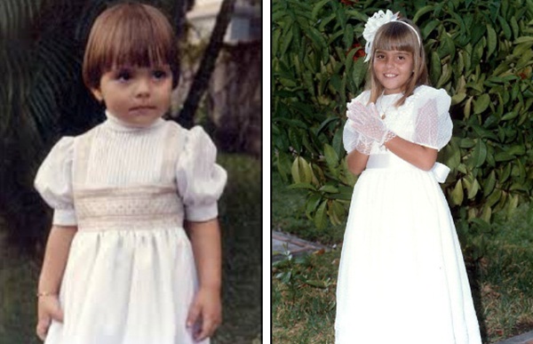 Cô gái mang khuôn mặt biến dạng khủng khiếp vì gã tài xế say rượu, dũng cảm đứng lên truyền cảm hứng sống cho hàng triệu người-2