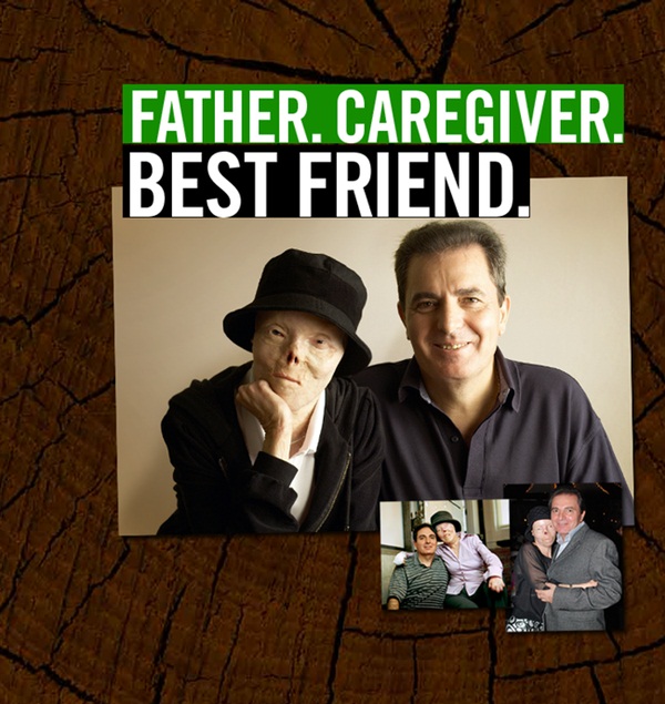 Cô gái mang khuôn mặt biến dạng khủng khiếp vì gã tài xế say rượu, dũng cảm đứng lên truyền cảm hứng sống cho hàng triệu người-9