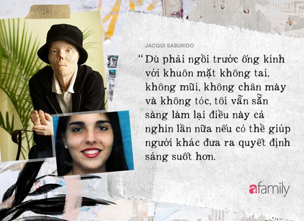 Cô gái mang khuôn mặt biến dạng khủng khiếp vì gã tài xế say rượu, dũng cảm đứng lên truyền cảm hứng sống cho hàng triệu người-16