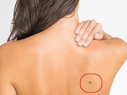 Chị em có dấu hiệu này, đến viện khám ngay kẻo ung thư-3