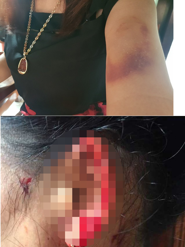 Nữ doanh nhân Quảng Bình tố bị súng bắn ngay giữa phố-1