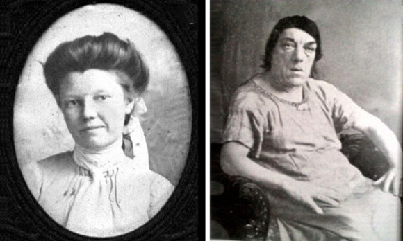 Câu chuyện cảm động về người phụ nữ mắc bệnh lạ xấu xí nhất thế giới, không sợ trở thành trò cười cho thiên hạ để cứu 4 đứa con khỏi chết đói-1