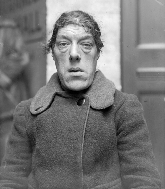 Câu chuyện cảm động về người phụ nữ mắc bệnh lạ xấu xí nhất thế giới, không sợ trở thành trò cười cho thiên hạ để cứu 4 đứa con khỏi chết đói-2