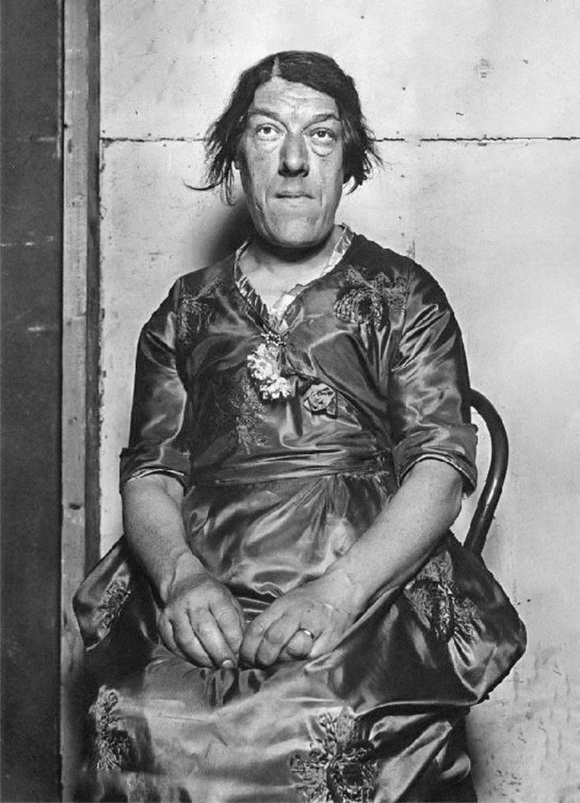 Câu chuyện cảm động về người phụ nữ mắc bệnh lạ xấu xí nhất thế giới, không sợ trở thành trò cười cho thiên hạ để cứu 4 đứa con khỏi chết đói-3