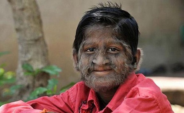 Top 10 căn bệnh kỳ lạ và đáng sợ nhất trên thế giới, y học chưa có lời giải-3