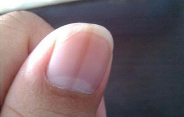 3 bộ phận này trên cơ thể ngày càng đen, báo hiệu gan đang suy yếu-2