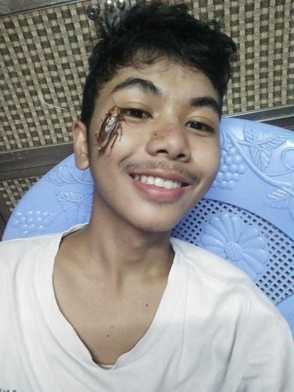 Sởn gai ốc trước thử thách đặt gián lên mặt làm khuynh đảo giới trẻ-1