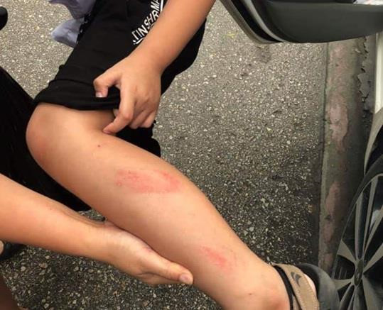 Cô giáo tát học sinh lớp 2 tím thái dương trong giờ kiểm tra học kỳ-1