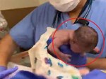 Vừa chào đời đã lập kỷ lục không ai muốn nhưng bé gái làm nên điều kỳ diệu khiến cả bác sĩ và bố mẹ đều ngỡ ngàng-4