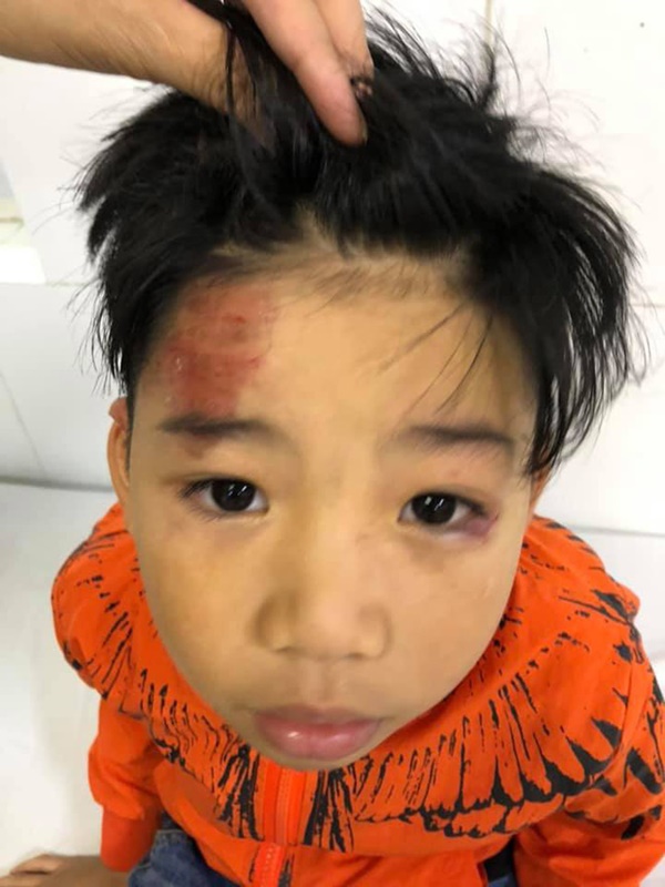 Hai con nhỏ của siêu mẫu Hạ Vy bị xe điên tông chấn thương não rồi bỏ chạy-1