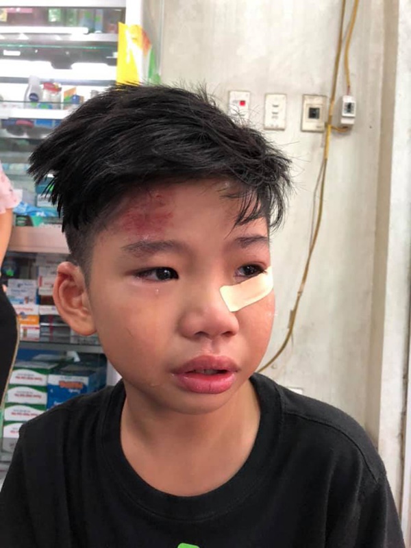 Hai con nhỏ của siêu mẫu Hạ Vy bị xe điên tông chấn thương não rồi bỏ chạy-2