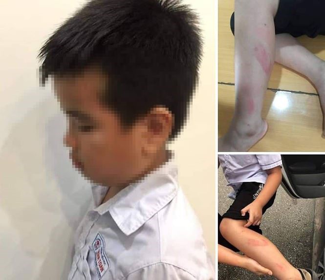 Vụ cô giáo đánh học sinh vì làm bài chậm: Đình chỉ dạy 6 tháng-1