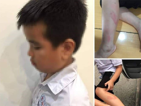 Mẹ nam sinh lớp 2 ở Hải Phòng đăng clip cô giáo tát tới tấp con mình, dùng thước vụt mạnh nhiều em khác-6