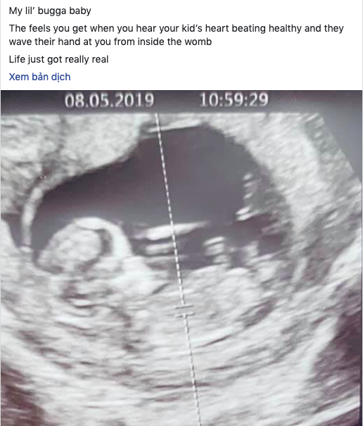 Chồng Lan Khuê khoe ảnh siêu âm thai nhi, chính thức xác nhận chuyện có em bé-1