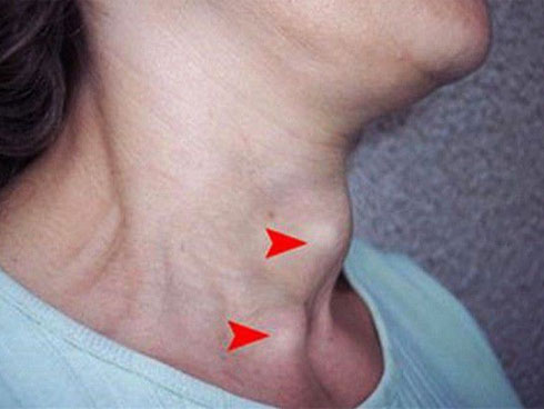 Chiếc vòng vàng ở tay con đột nhiên biến mất, 4 ngày sau mẹ phát hiện điều kinh hoàng-2